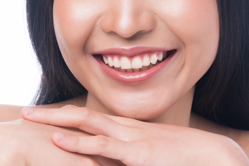 Veneers: Improve Your Smile and Boost Your Confidence